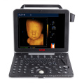 UW-P6 Portable Color Doppler 4D Ultrasound scanner